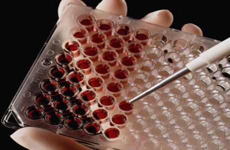 Transmissão heterossexual do HIV: novas descobertas