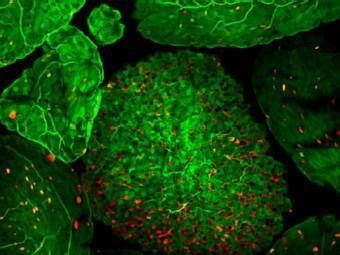 Cientistas prestes a criar vacinas orais para doenças intestinais