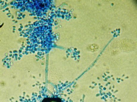 O agente causador do favus (Trichophyton schoenleinii)
